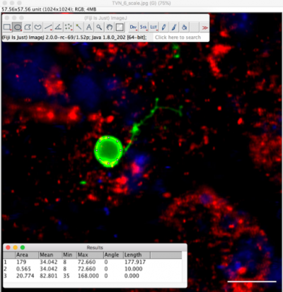 Example of microscopy analysis to measure the size of a Plasmodium vivax parasite 